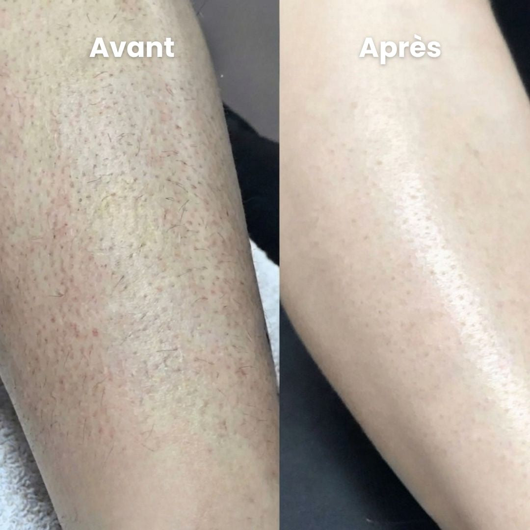 Rasoir Anti-Irritation Peaux Sensibles