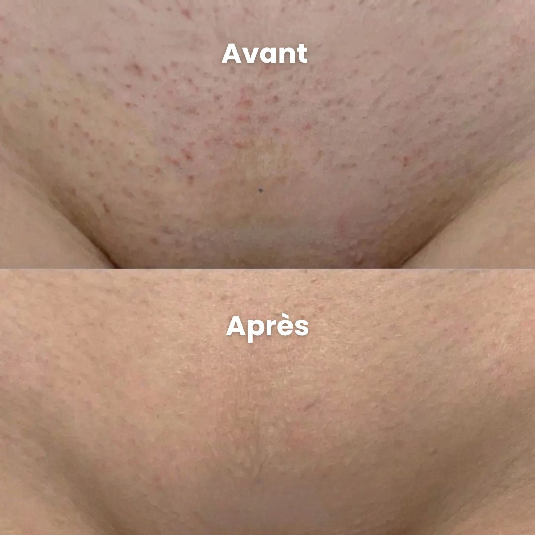 Rasoir Anti-Irritation Peaux Sensibles