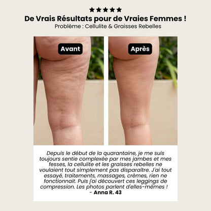 Legging Sculptant Anti-Cellulite 3D